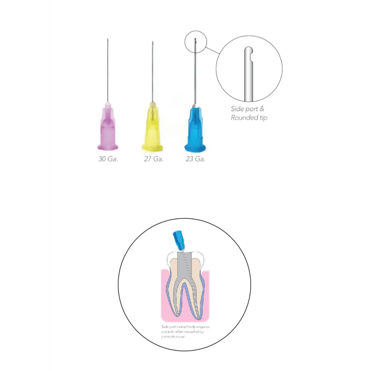 Pac-Dent - OptiProbe, Endo Irrigation Needles, Side-Vent, 30 Ga, Purple, 100/Pk