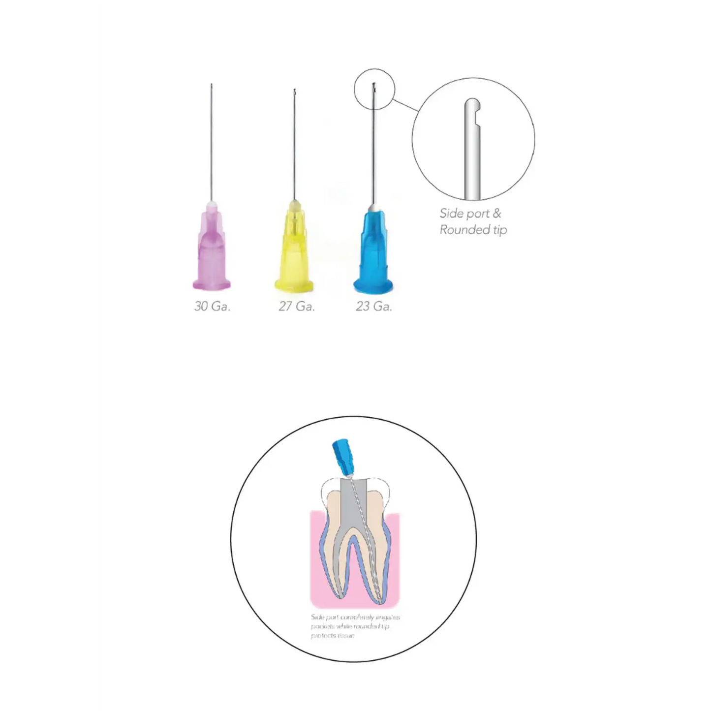 Pac-Dent - OptiProbe, Endo Irrigation Needles, Side-Vent, 27 Ga, Yellow, 100/Pk