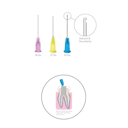 Pac-Dent - OptiProbe, Endo Irrigation Needles, Side-Vent, 27 Ga, Yellow, 100/Pk