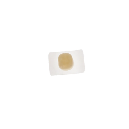 Protemp Crown Refill LL Molar 5/Pk