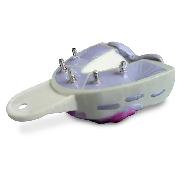 Miratray Implant Advanced Intro Kit 6/Bx