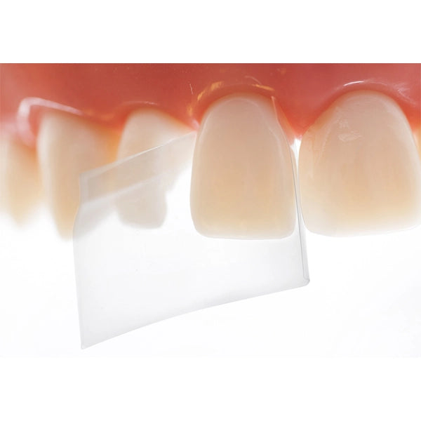 Directa - ProxyPal 3D Anterior Matrix