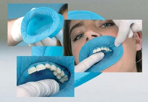 OptraDam Plus Assortment/50